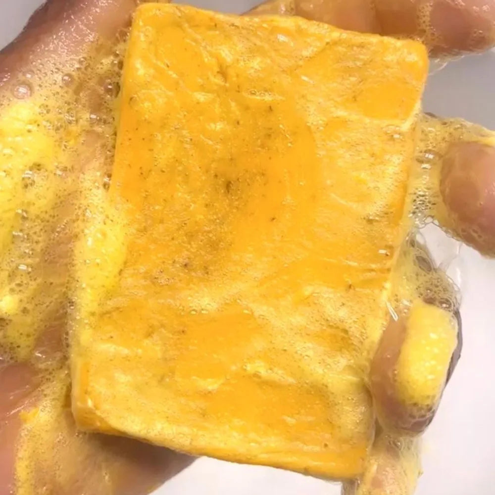 Golden Glow Turmeric & Kojic Acid Soap — Handcrafted Brightening Bar